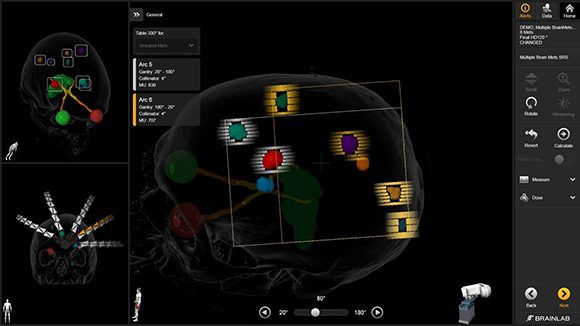 Brainlab Elements