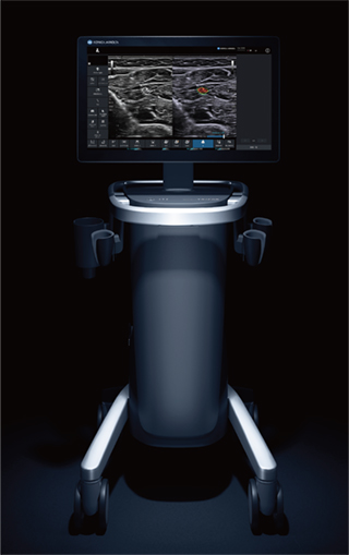SONIMAGE UX1 TRiFOR