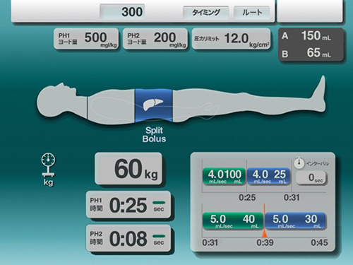 Split-Bolus Protocol