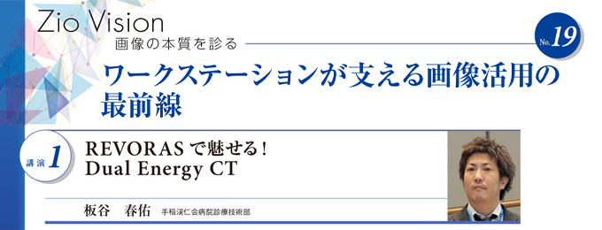 REVORAS で魅せる！　Dual Energy CT