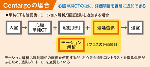 図2 Centargoを用いた場合の心臓CT検査手順 図2 Centargoを用いた場合の心臓CT検査手順