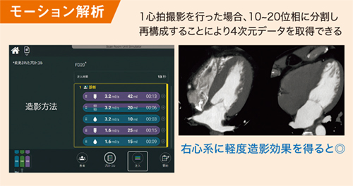 図5 モーション解析の撮影プロトコル 図5 モーション解析の撮影プロトコル