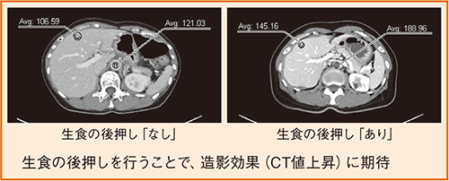 図2 生食の後押し効果（肝実質、大動脈のCT値（HU））（自験例）