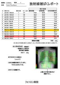 図3　放射線被ばくレポート　検査ごとのレポートのみならず患者ごとの被ばく線量の累積レポートも作成可能