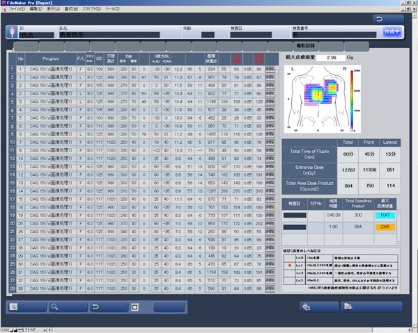 図3　線量管理ソフト 面積線量計，X線保持装置の情報，寝台の情報より寝台に横たわっている患者の皮膚面の入射線量を計算するもの。これによりどこの部分にどれだけ線量が照射されたか管理できる。