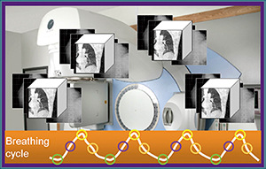 図1　Elekta Synergyにおける4D-CBCTの原理