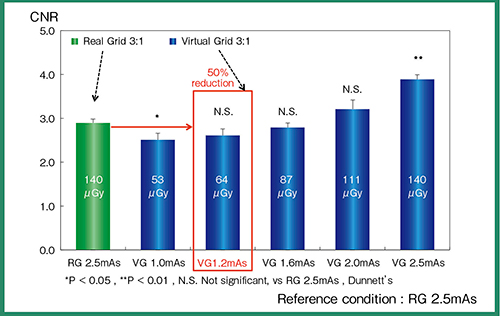 図4　Virtual Gridと実グリッドの撮影条件の検討：CNR