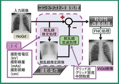 図1　散乱線除去用画像処理技術（Virtual Grid）の概要