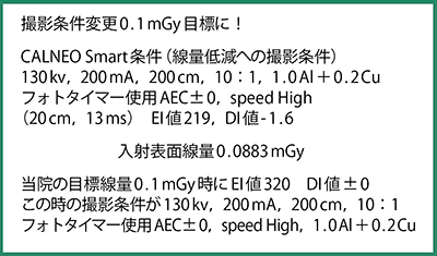 図5　当院におけるCALNEO Smartの新撮影条件