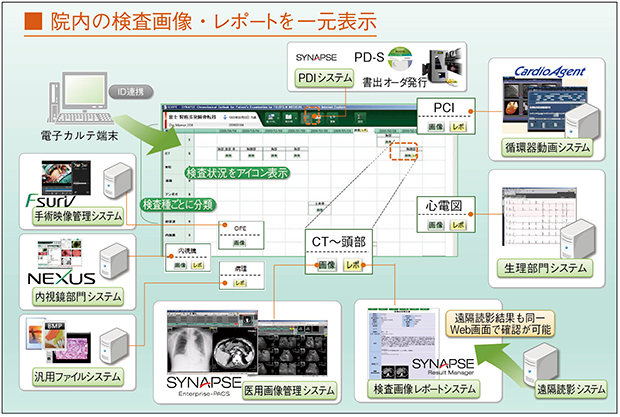 ポータルビューワ「SYNAPSE SCOPE」による検査画像・レポートの表示