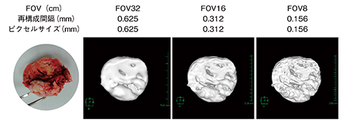 図2　骨頭切断面のSTL形式サーフェス表示（FOV・再構成間隔・ピクセルサイズとの関係）