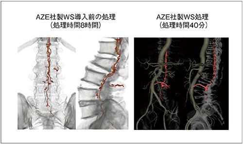 図4　AZE社製WS導入前と導入後の違い