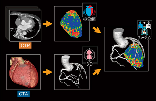 図1　フュージョン画像の作成