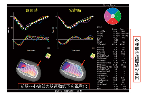 図2　HRV-F解析結果：容量曲線と心機能指標値表示