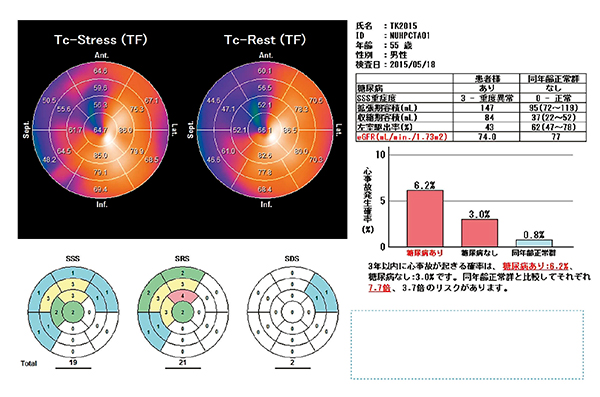 図5　HRV-S：Risk解析結果