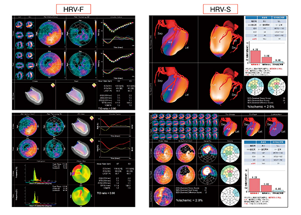 図6　心臓解析パッケージ：解析結果レポート表示例