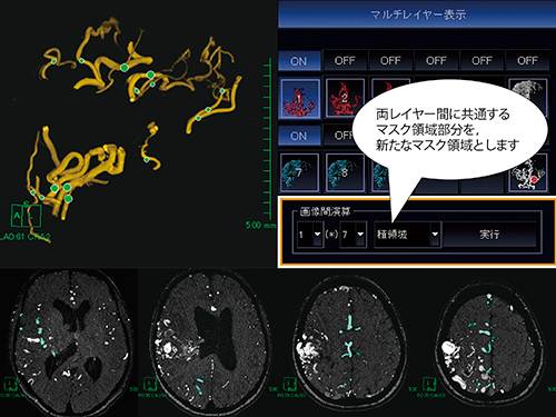 図3　画像間演算を使用し，重なったマスク領域だけを抽出