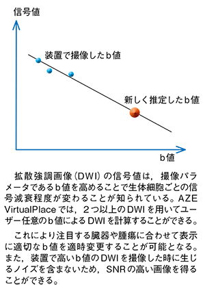 図1　cDWIの原理