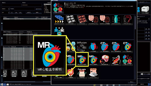 図1　MR心駆出率解析