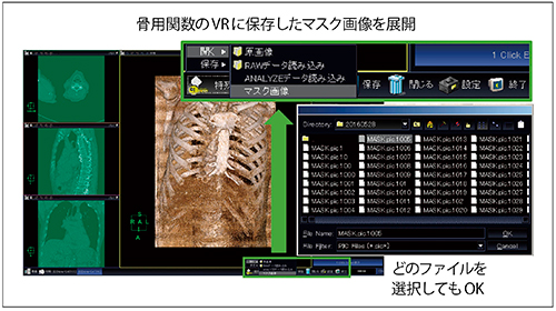 図4　マスク画像データの展開