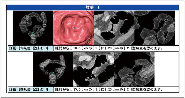 図8　大腸解析レポート（病変部）