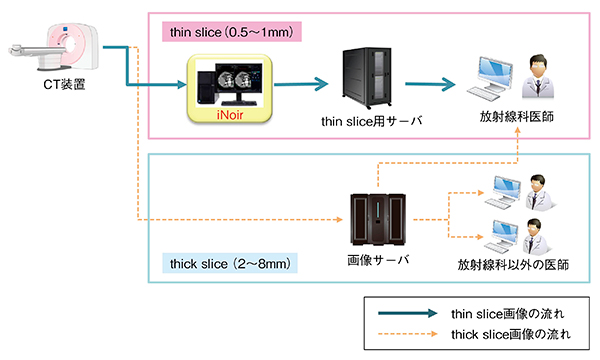 図4　当院におけるCT画像転送経路