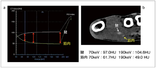 図1　仮想単色X線エネルギーとCT値の相関グラフ グラフ（a）は，腱と筋肉にROIを置き（b），仮想単色X線エネルギーを変化させた時のCT値の変化を示したものである。電圧が上がると，白グラフの腱はCT値が微増し，黄色グラフの筋肉はCT値が大きく低下する。よってエネルギーを上げていくと相対的にコントラストを上昇できる。