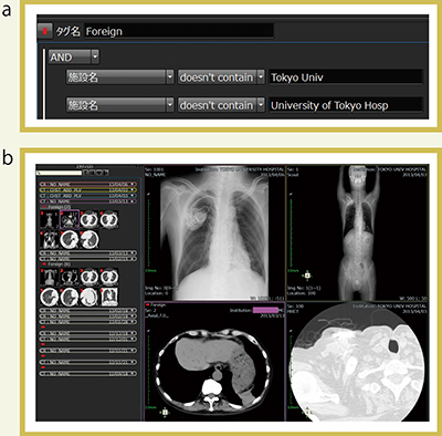 図5　他院からの紹介画像の管理 a　「東大病院以外」の条件でタグ（→）を設定 b　タグにより画像を強調し見逃しを防ぐ。