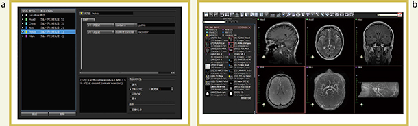 図6　読影順番通りにシリーズを交換 a　部位別でグループ化し優先順位を設定 b　タグをドラッグ＆ドロップすることで関連シリーズをタブとして展開