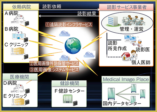 図1　MIP概念図