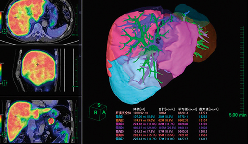 図3　肝臓解析