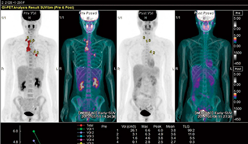 図4　PET解析