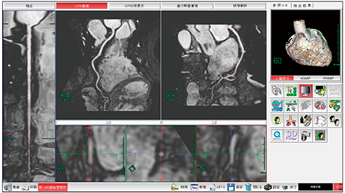 図2　MR細血管解析