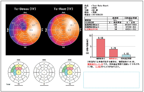 図6　Heart Risk View-Sのリスク表示機能