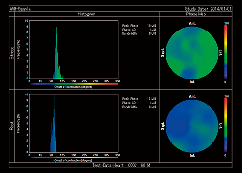 図7　Heart Risk View-Fによる位相解析