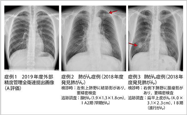 CXDIによる臨床画像