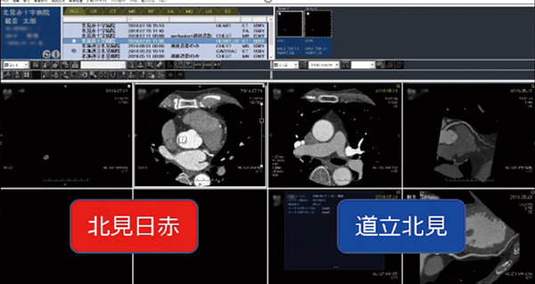 図2　RapideyeCoreのビューワでの2病院の画像情報の参照