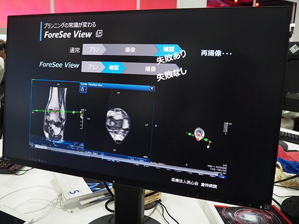 撮像プランニングをアシストする“ForeSee View”