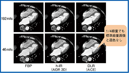 図5　各線量域における心臓CT画像の比較