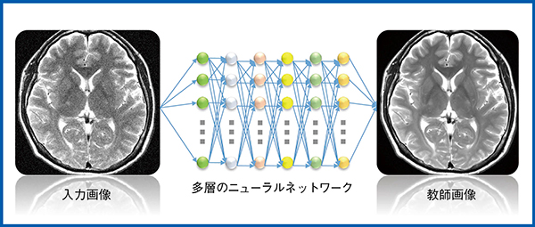 図1　DLRの概念