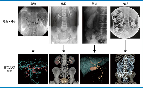 図1　三次元CT画像による造影X線検査の置換