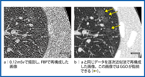 図2　逐次近似法による画質の向上