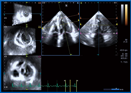 図7　症例5の超音波4D画像