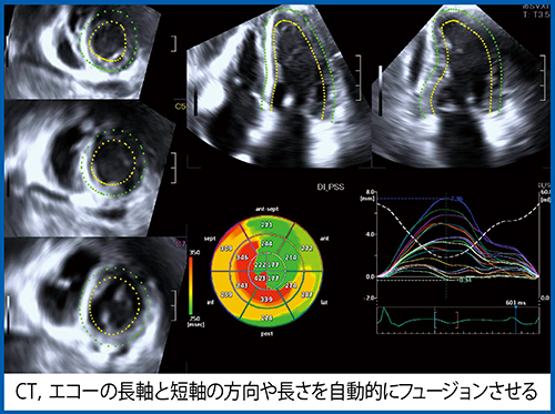 図8　症例5の3D-WMT，DI-PSS