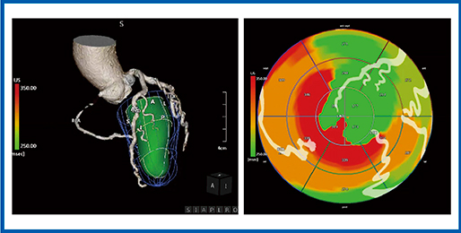 図9　症例5のUS Cardiac Fusion