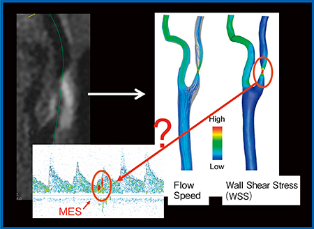 図5　CFD解析によるflow speedとWSSのマッピング