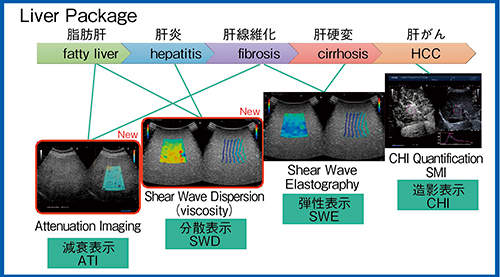 図1　Liver Package