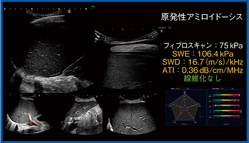 図10　Multi Parametric Report