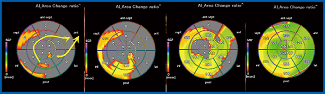 図8　Activation Imagingによる体循環心室左室の興奮伝搬