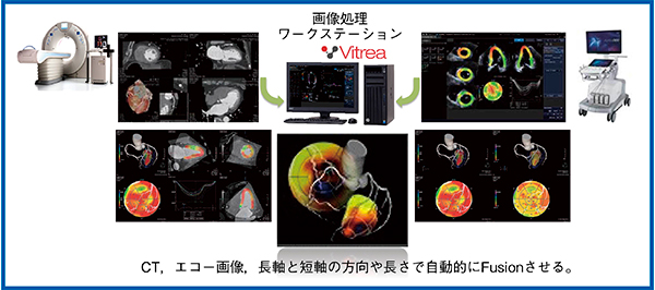 図2　US Cardiac Fusionの概要